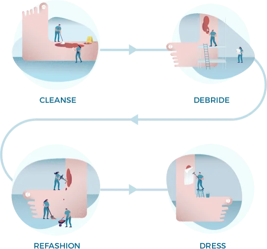 Illustration af Wound hygienes 4 trin: Rens, Debrider, Optimer, bandagér